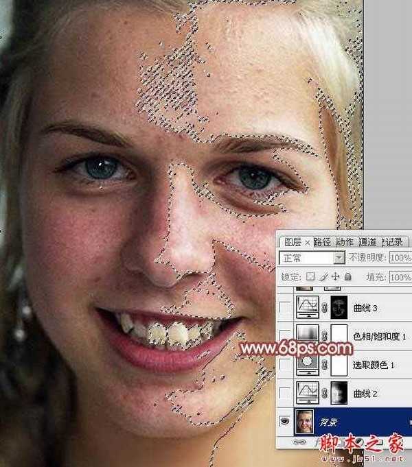photoshop利用通道为满脸痘痘人物磨皮教程